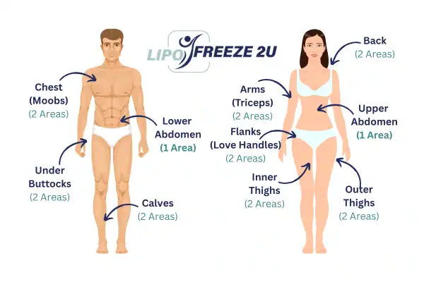 Areas you can have fat freezing treatment Wembley