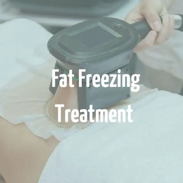 fat freezing treatment Wembley