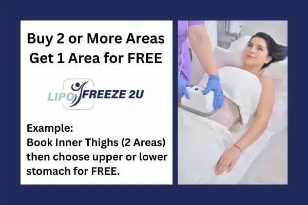 fat freezing prices Wembley