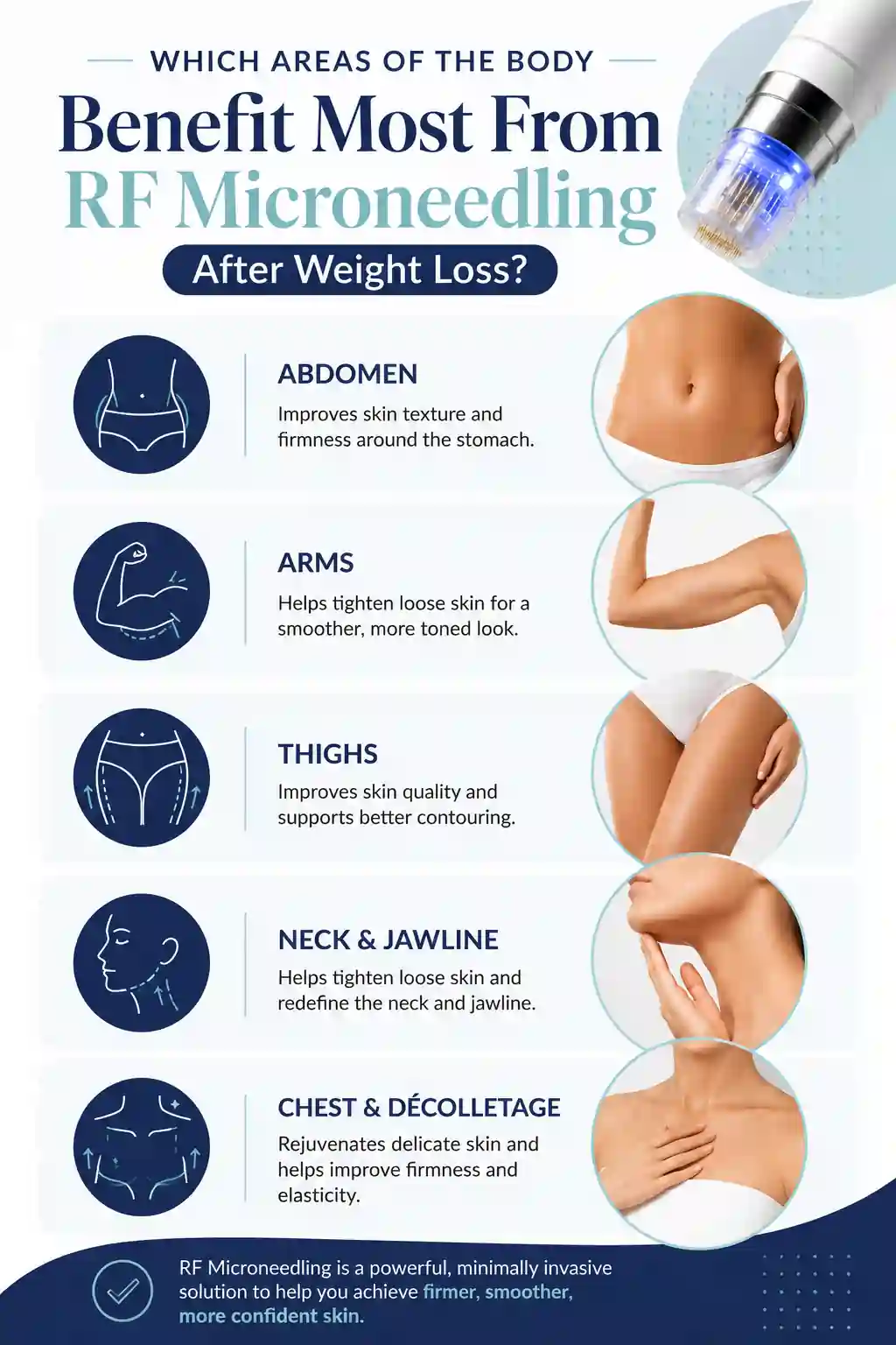 Which Areas of the Body Benefit Most From RF Microneedling After Weight Loss Wembley